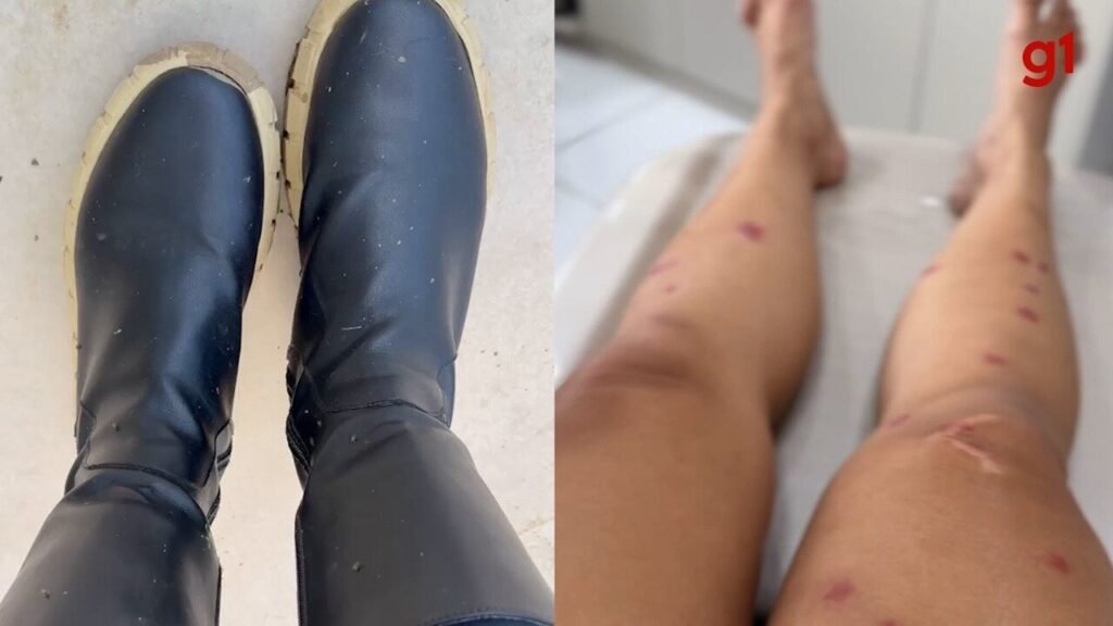 Surto de Mosquitos Borrachudos Muda Rotina de Moradorores de Bairros do Rio e Gera Alergia E Feridas: 'Nem Roupa Grossa Adianta' | Rio de Janeiro