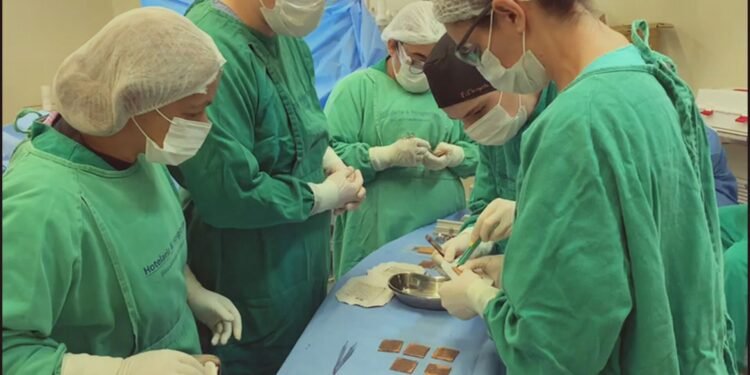 Tratamento de Queimadas No Hospital Pedro II Tratamento de Queimadas No Hospital Pedro II