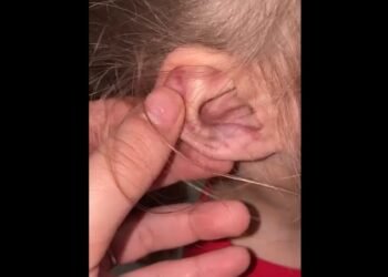 Criança de 3 Anos É Brutalmente Agredida em Cachariras de Macacu, sem RJ