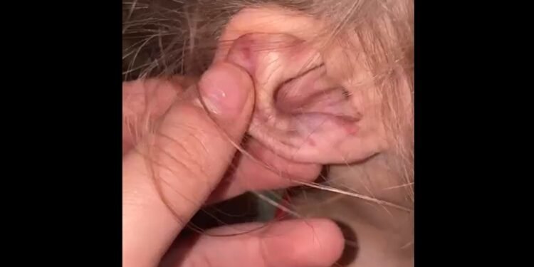 Criança de 3 Anos É Brutalmente Agredida em Cachariras de Macacu, sem RJ