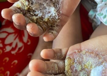 Polícia prenda Mãe por torturar a fila com ovo em estado de fervura em niterói