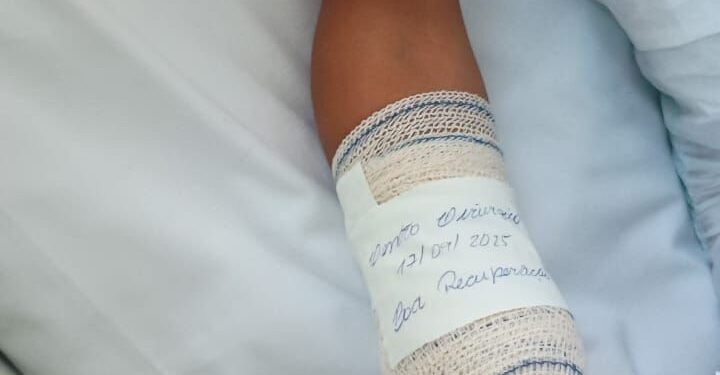 Menino de 8 Anos Perde A Mão e Dedos do Pé Após Explosão em Costa Barros
