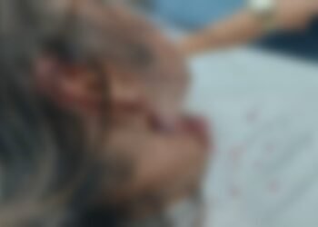 Mulher relata ataque de pitbull ao tentar ajudar outro cão em Marechal Hermes