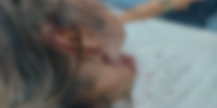 Mulher relata ataque de pitbull ao tentar ajudar outro cão em Marechal Hermes