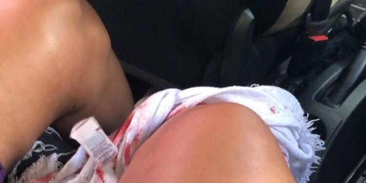 Grávida é baleada ao ficar no meio de tiroteio na Zona Sudoeste do Rio e passa por parte de emergência Grávida é baleada ao ficar no meio de tiroteio na Zona Sudoeste do Rio e passa por parte de emergência