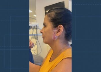 Dentista é presa, e clínica é interditada após cliente ter rosto deformado no Recreio