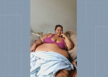 Paciente perde 120kg em enfermaria no Rio