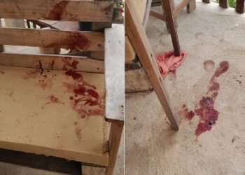 Bebê de 10 meses é atacado por pitbull e segue internado em estado grave em Campos