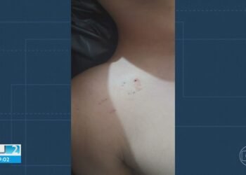 Adolescente de 13 anos morre com suspeita de picada de cobra em Itaguaí