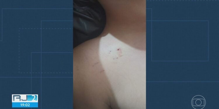 Adolescente de 13 anos morre com suspeita de picada de cobra em Itaguaí