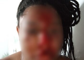 Mulher é agredida pelo ex-companheiro dentro de casa em Araruama