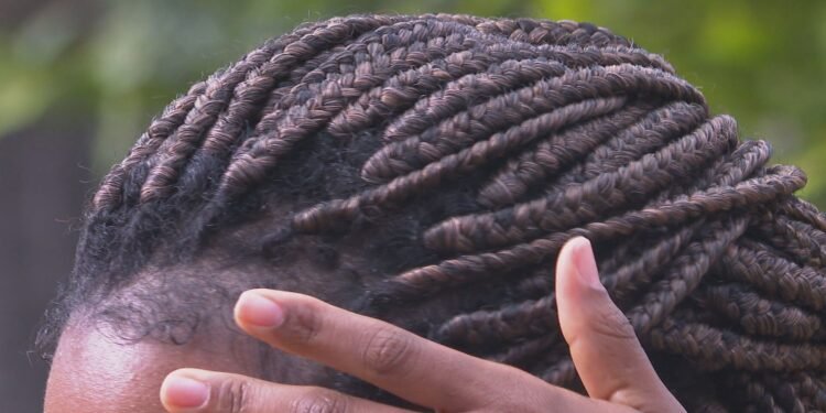 Atendimentos por lesões nos olhos ligados ao uso de pomadas para cabelos sobem quase 200% no Rio