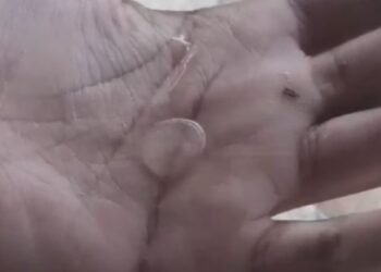 Grande Rio tem chuva forte e até granizo em algumas regiões