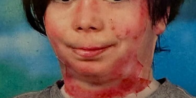 Morre Theo Colker, neto de Deborah Colker, que enfrentou doença rara Morre Theo Colker, neto de Deborah Colker, que enfrentou doença rara