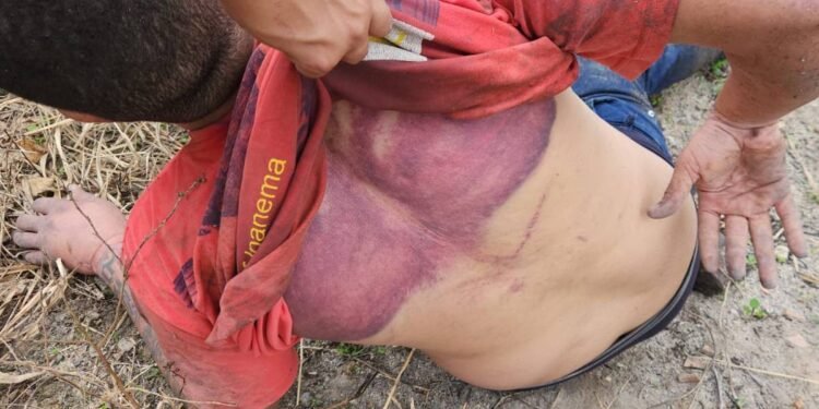 Entenda o que se sabe sobre sequestro e tortura de motorista por aplicativo na Bahia