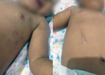 Casal é preso por maus-tratos contra criança de 2 anos no Rio