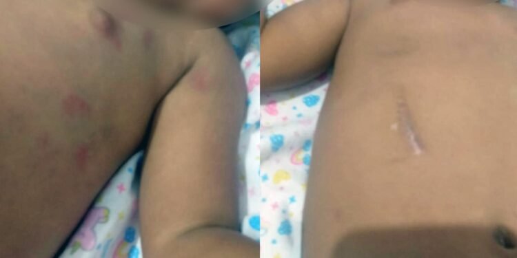 Casal é preso por maus-tratos contra criança de 2 anos no Rio Casal é preso por maus-tratos contra criança de 2 anos no Rio