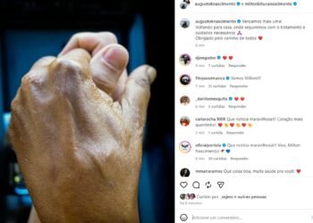 Filho de Milton Nascimento anuncia alta hospitalar do cantor após pneumonia