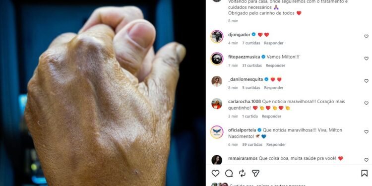 Filho de Milton Nascimento anuncia alta hospitalar do cantor após pneumonia
