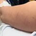 Mulher relata ter sido atacada com tesoura durante assalto em São Gonçalo; um dos golpes foi na barriga