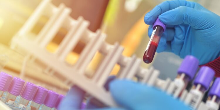 Pesquisa com mais de 28 mil pessoas descobre ‘freio’ que pode ser chave para novos tratamentos de doenças hereditárias do sangue Pesquisa com mais de 28 mil pessoas descobre ‘freio’ que pode ser chave para novos tratamentos de doenças hereditárias do sangue