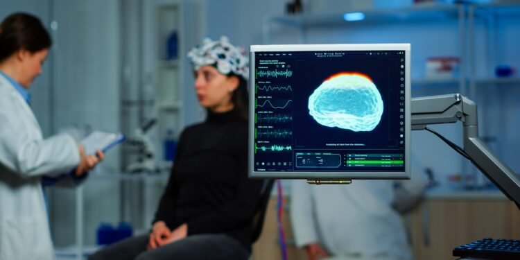Alzheimer: estudo identifica ondas cerebrais que podem ajudar a prever risco da doença