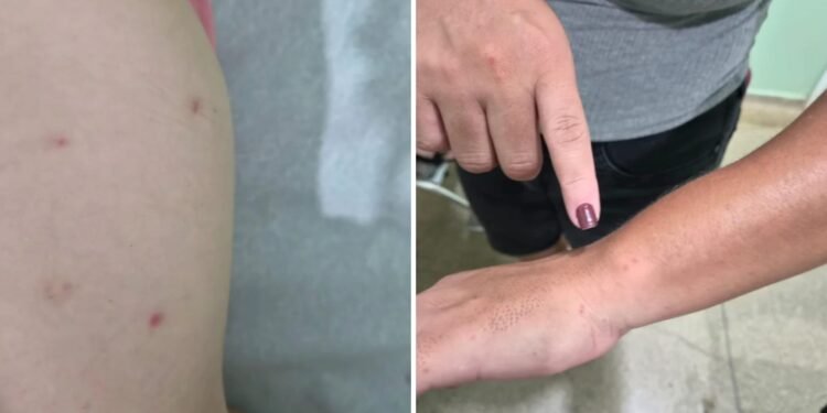 Coceiras, manchas na pele: o que indicam os sintomas apresentados por adultos e crianças em Brodowski, SP Coceiras, manchas na pele: o que indicam os sintomas apresentados por adultos e crianças em Brodowski, SP
