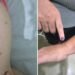 Coceiras, manchas na pele: o que indicam os sintomas apresentados por adultos e crianças em Brodowski, SP Coceiras, manchas na pele: o que indicam os sintomas apresentados por adultos e crianças em Brodowski, SP