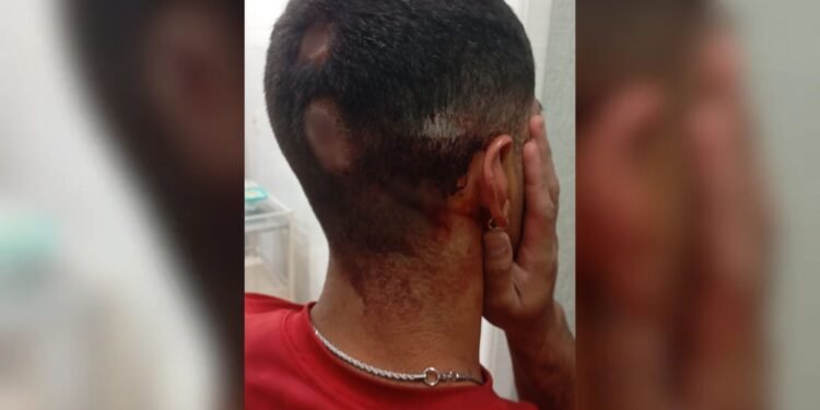 Jovem é agredido por grupo vestido de verde e amarelo ao comemorar vitória de Lula em praça; vídeo Jovem é agredido por grupo vestido de verde e amarelo ao comemorar vitória de Lula em praça; vídeo