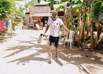 Líder comunitário que teve perna amputada consegue prótese com apoio da DPE-RR: ‘mudou a minha vida’
