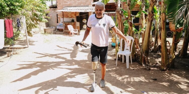 Líder comunitário que teve perna amputada consegue prótese com apoio da DPE-RR: ‘mudou a minha vida’ Líder comunitário que teve perna amputada consegue prótese com apoio da DPE-RR: ‘mudou a minha vida’
