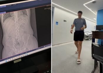 Jovem engole aliança sem querer, vai parar no hospital e viraliza na web; VÍDEO Jovem engole aliança sem querer, vai parar no hospital e viraliza na web; VÍDEO