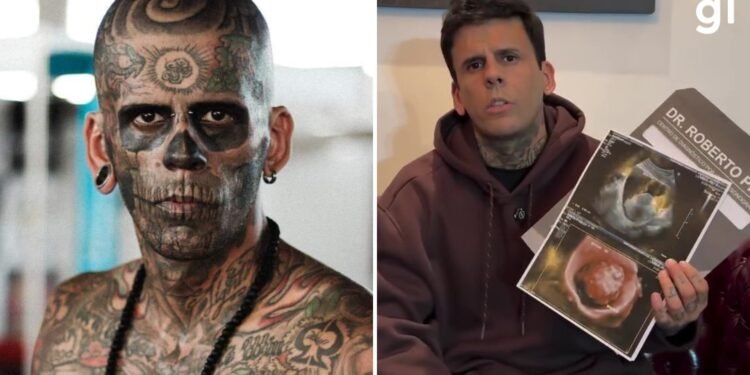 ‘Mais tatuado do Brasil’ conta que fará tratamento contra câncer pelo SUS ‘Mais tatuado do Brasil’ conta que fará tratamento contra câncer pelo SUS