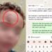 Mãe denuncia creche após menino de 2 anos aparecer com hematoma no rosto no litoral de SP Mãe denuncia creche após menino de 2 anos aparecer com hematoma no rosto no litoral de SP